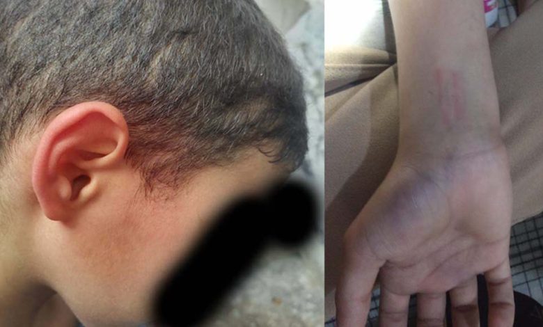 صورة طنجة.. أستاذ يقوم بتعنيف تلميذ داخل القسم داخل مدرسة المختار السوسي بحي بنديبان
